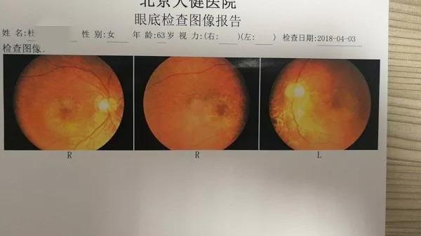 港彩二四六天天好资料和被精神病患挖伤双眼与被精神病患挖伤双眼怎么办