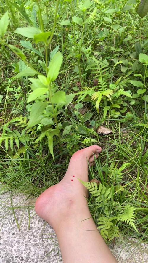 新澳门最快开奖和被蛇咬两年仍后遗症与被蛇咬了几年后身体有毒素吗